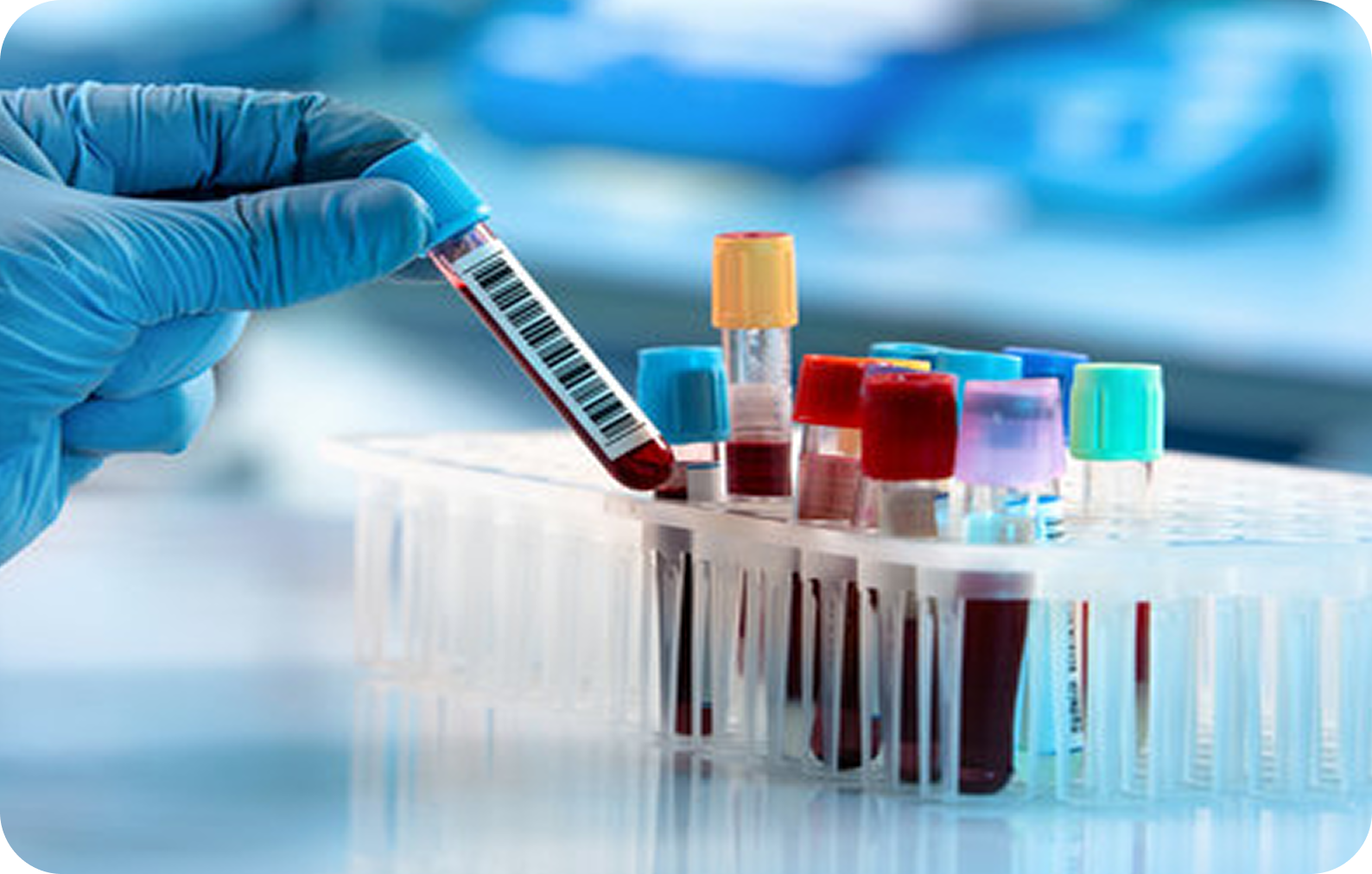 Lab technician with test tubes